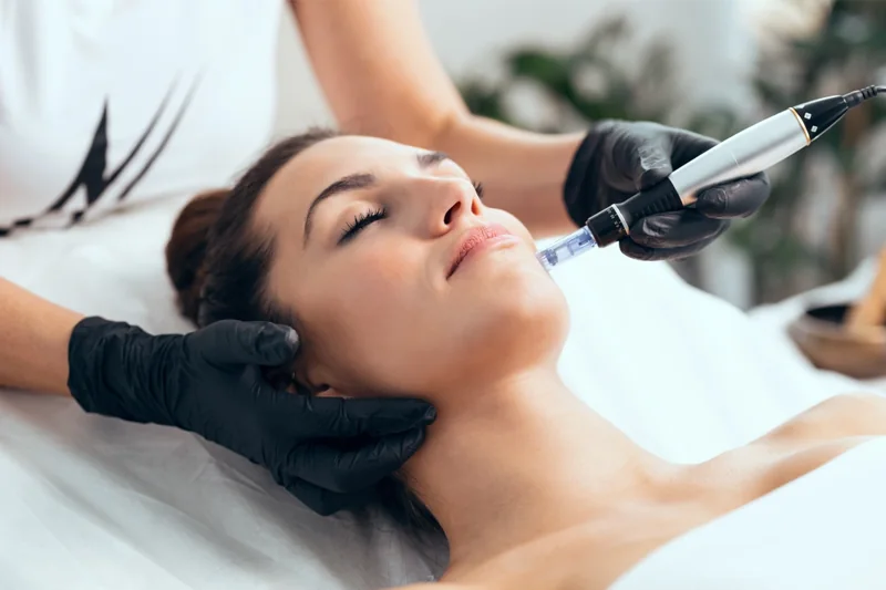 A practitioner holding a microneedling pen near the cheek